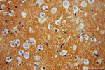 FN3KRP Antibody in Immunohistochemistry (Paraffin) (IHC (P))