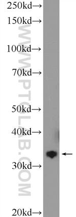 FN3KRP Antibody in Western Blot (WB)