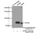 AP4B1 Antibody in Immunoprecipitation (IP)