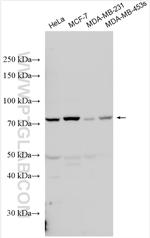 AP4B1 Antibody in Western Blot (WB)