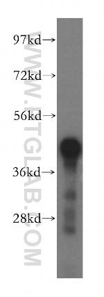 GCAT Antibody in Western Blot (WB)