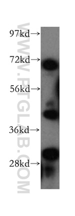 GCAT Antibody in Western Blot (WB)