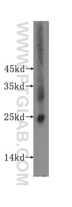 Placental lactogen Antibody in Western Blot (WB)