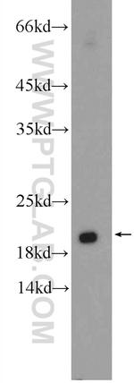 RAB30 Antibody in Western Blot (WB)