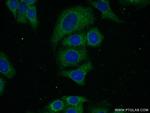 BTD Antibody in Immunocytochemistry (ICC/IF)