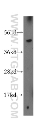 BTD Antibody in Western Blot (WB)
