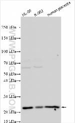 PKD1L2 Antibody in Western Blot (WB)