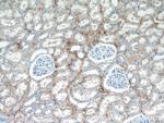 ABP1 Antibody in Immunohistochemistry (Paraffin) (IHC (P))