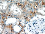 ABP1 Antibody in Immunohistochemistry (Paraffin) (IHC (P))