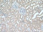 ABP1 Antibody in Immunohistochemistry (Paraffin) (IHC (P))