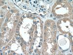 ABP1 Antibody in Immunohistochemistry (Paraffin) (IHC (P))