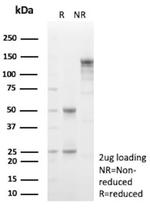 Decorin Antibody in SDS-PAGE (SDS-PAGE)