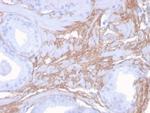 Decorin Monoclonal Antibody (DCN, 3523)