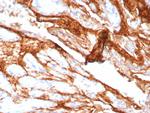 Decorin Recombinant Rabbit Monoclonal Antibody (DCN/8760R)