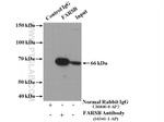 FARSB Antibody in Immunoprecipitation (IP)