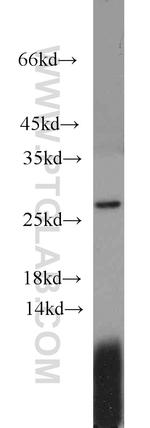 GINS3 Antibody in Western Blot (WB)