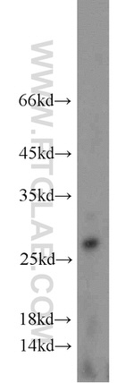 GINS3 Antibody in Western Blot (WB)