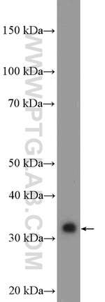 SULT2A1 Antibody in Western Blot (WB)
