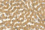 CYP2C9 Antibody in Immunohistochemistry (Paraffin) (IHC (P))