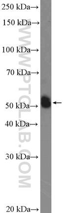 CYP2C9 Antibody in Western Blot (WB)