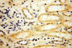 MRPS21 Antibody in Immunohistochemistry (Paraffin) (IHC (P))
