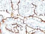 Angiotensin I Converting Enzyme (ACE)/CD143 Monoclonal Antibody (ACE/3763)