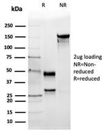 Angiotensin I Converting Enzyme (ACE)/CD143 Antibody in Immunoelectrophoresis (IE)
