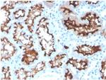 Angiotensin I Converting Enzyme (ACE)/CD143 Antibody in Immunohistochemistry (Paraffin) (IHC (P))