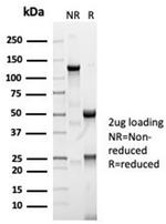 Angiotensin I Converting Enzyme (ACE)/CD143 Recombinant Rabbit Monoclonal Antibody (ACE/7004R)