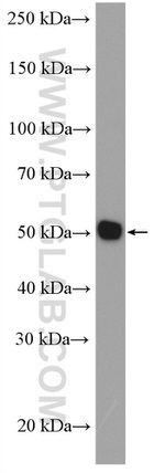 TXNRD2 Antibody in Western Blot (WB)
