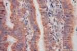 TXNRD2 Antibody in Immunohistochemistry (Paraffin) (IHC (P))