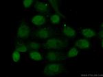 NOL6 Antibody in Immunocytochemistry (ICC/IF)