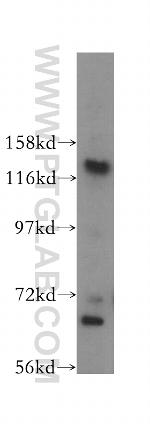 NOL6 Antibody in Western Blot (WB)
