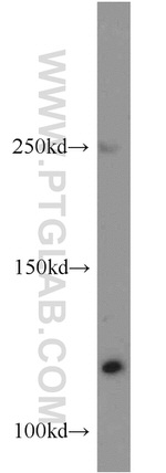 NOL6 Antibody in Western Blot (WB)