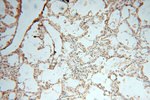 VAV1 Antibody in Immunohistochemistry (Paraffin) (IHC (P))