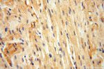 VAV1 Antibody in Immunohistochemistry (Paraffin) (IHC (P))