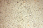 VAV1 Antibody in Immunohistochemistry (Paraffin) (IHC (P))
