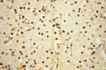 VAV1 Antibody in Immunohistochemistry (Paraffin) (IHC (P))