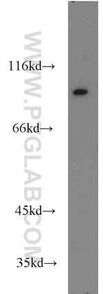 VAV1 Antibody in Western Blot (WB)