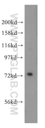 PIGO Antibody in Western Blot (WB)