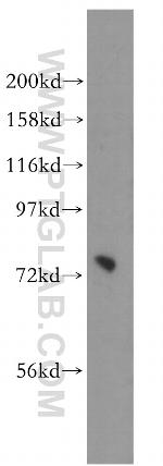 PIGO Antibody in Western Blot (WB)