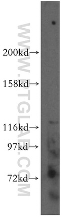 PIGO Antibody in Western Blot (WB)