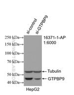 GTPBP9 Antibody in Western Blot (WB)