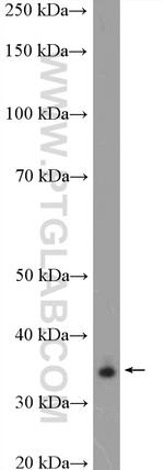 ALX1 Antibody in Western Blot (WB)