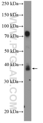 ALX1 Antibody in Western Blot (WB)