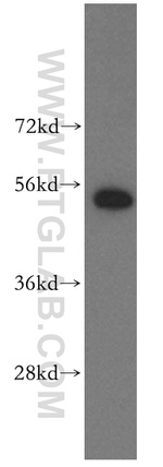 HARS Antibody in Western Blot (WB)
