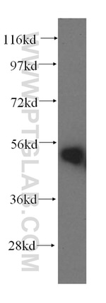 HARS Antibody in Western Blot (WB)