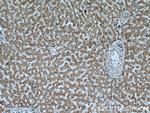 GSNOR/ADH5 Antibody in Immunohistochemistry (Paraffin) (IHC (P))