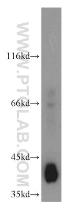 GSNOR/ADH5 Antibody in Western Blot (WB)