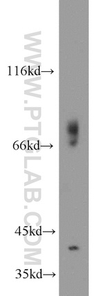 GSNOR/ADH5 Antibody in Western Blot (WB)